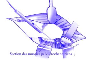 fig11