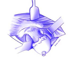 fig12