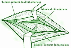 fig3