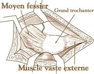 fig4