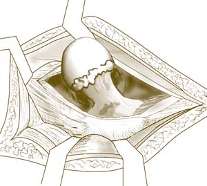fig6